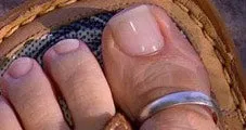 5mm Bold Big Toe